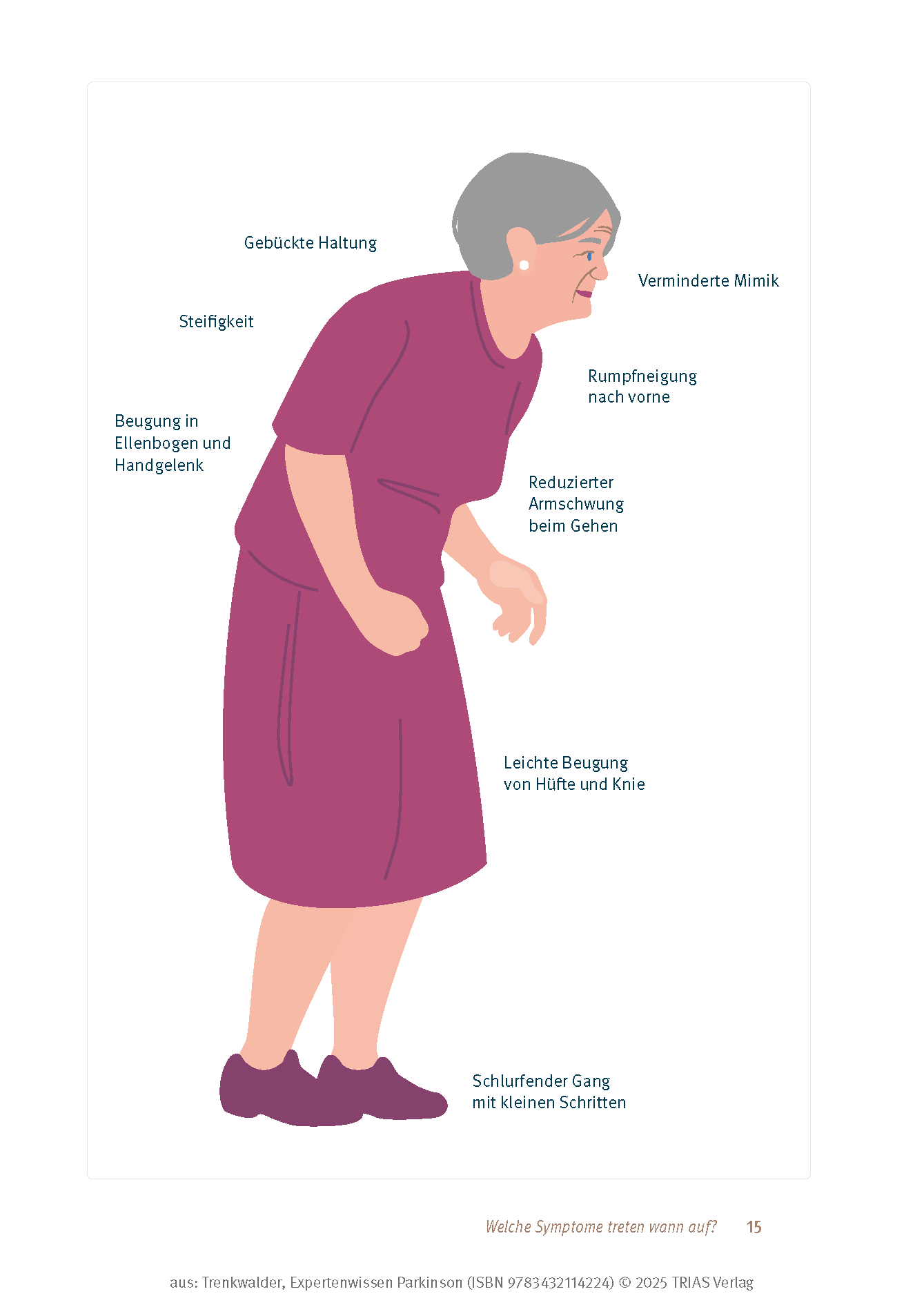 Expertenwissen: Parkinson