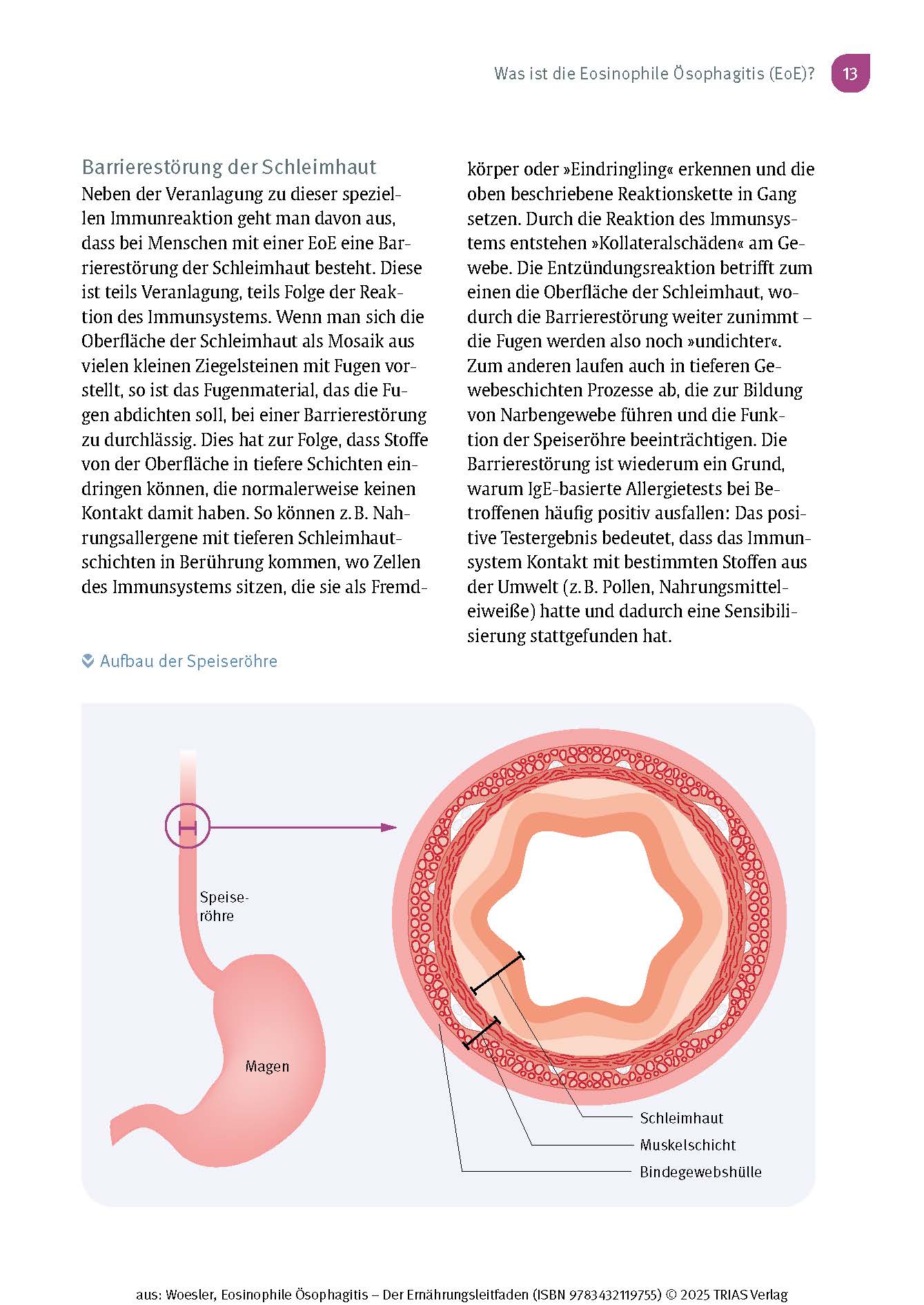 Eosinophile Ösophagitis - Der Ernährungsleitfaden