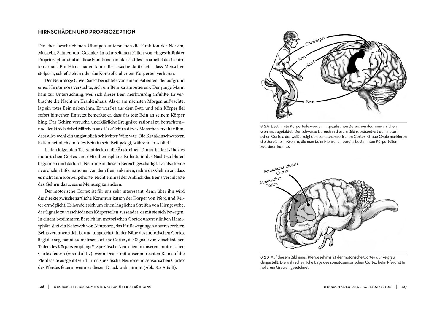 Horse Brain, Human Brain