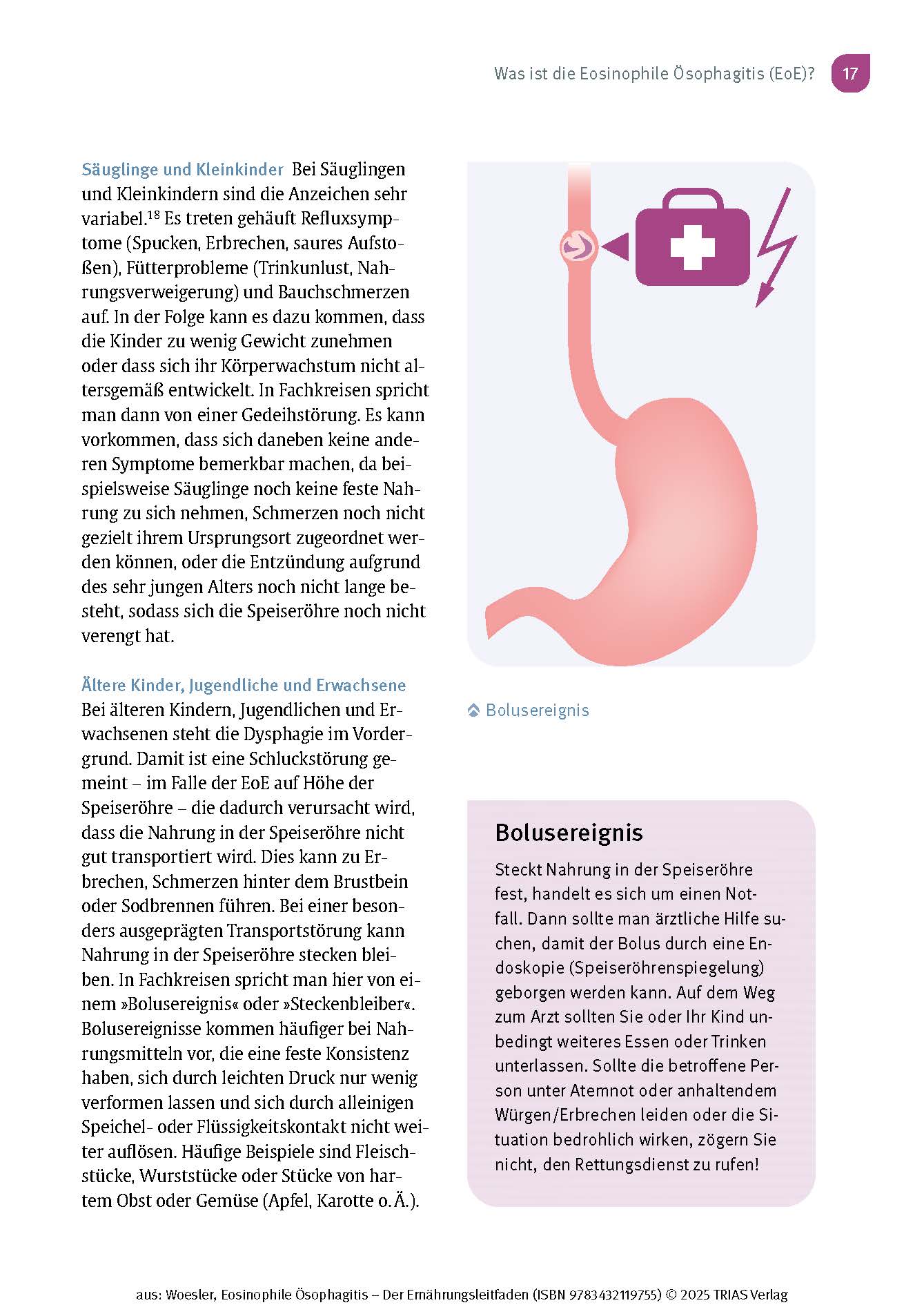 Eosinophile Ösophagitis - Der Ernährungsleitfaden