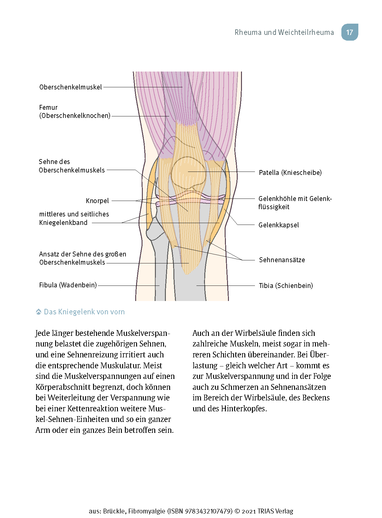Fibromyalgie Fibromyalgie