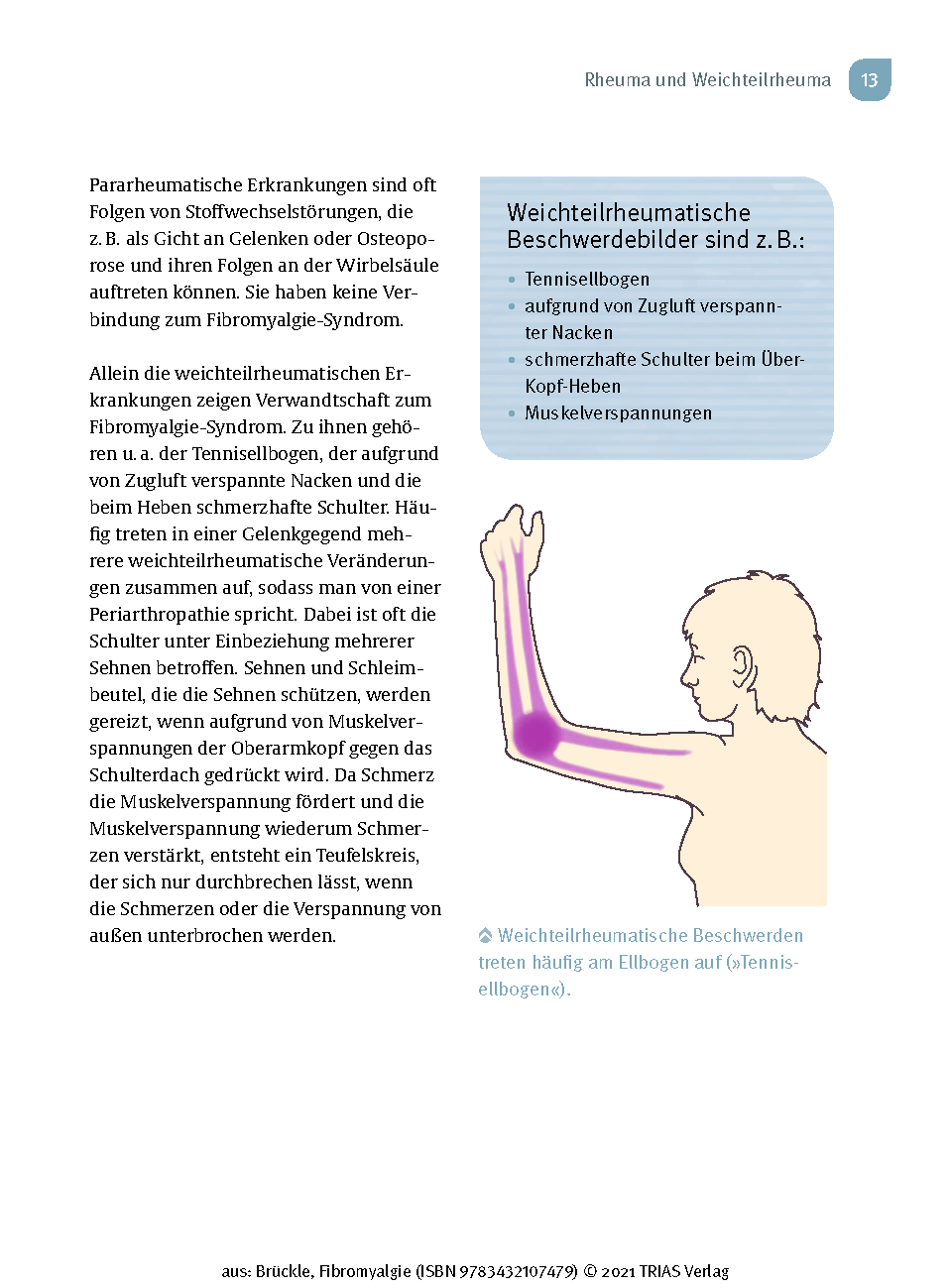 Fibromyalgie Fibromyalgie