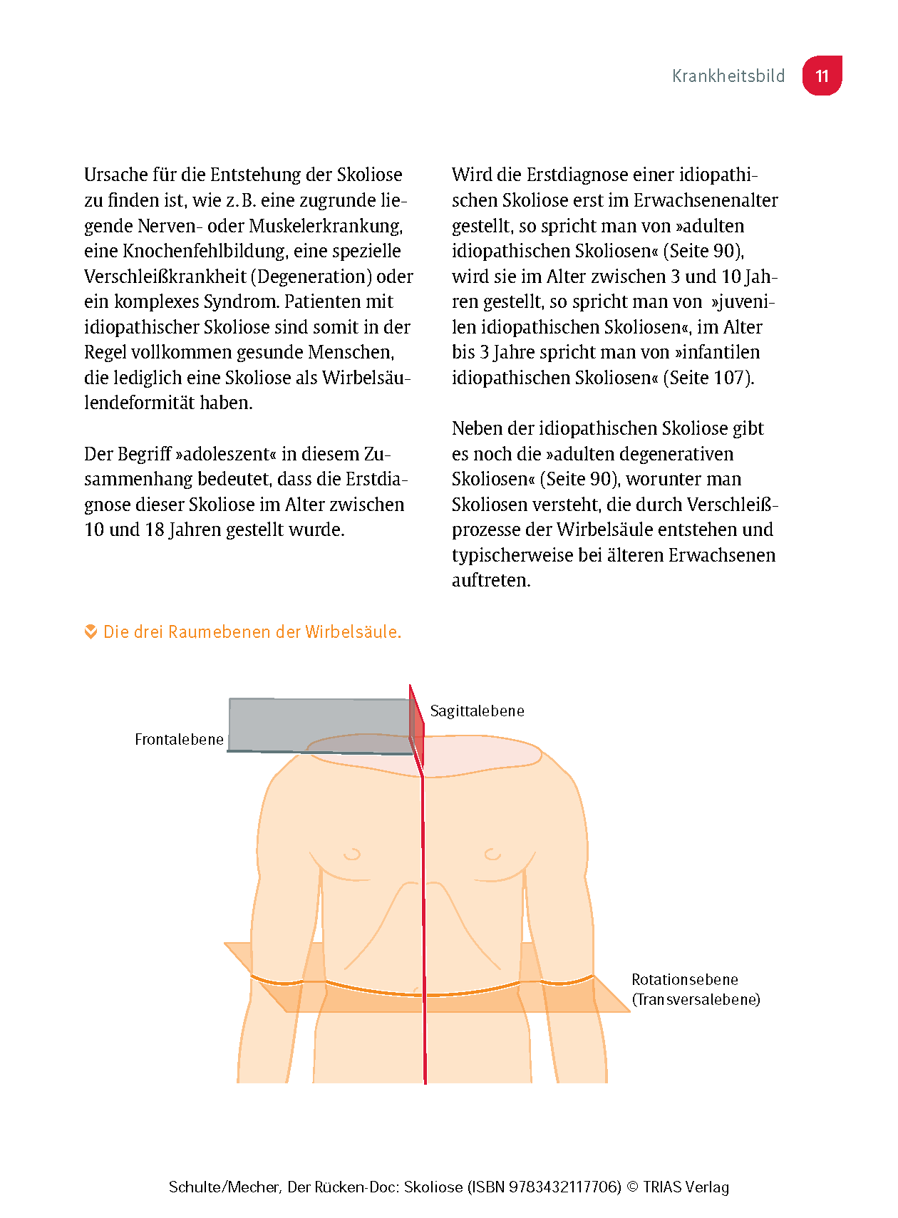 Der Rücken-Doc: Skoliose