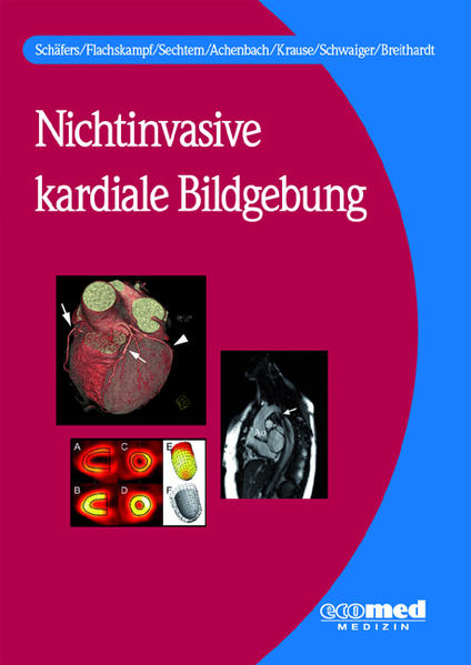 Nichtinvasive kardiale Bildgebung