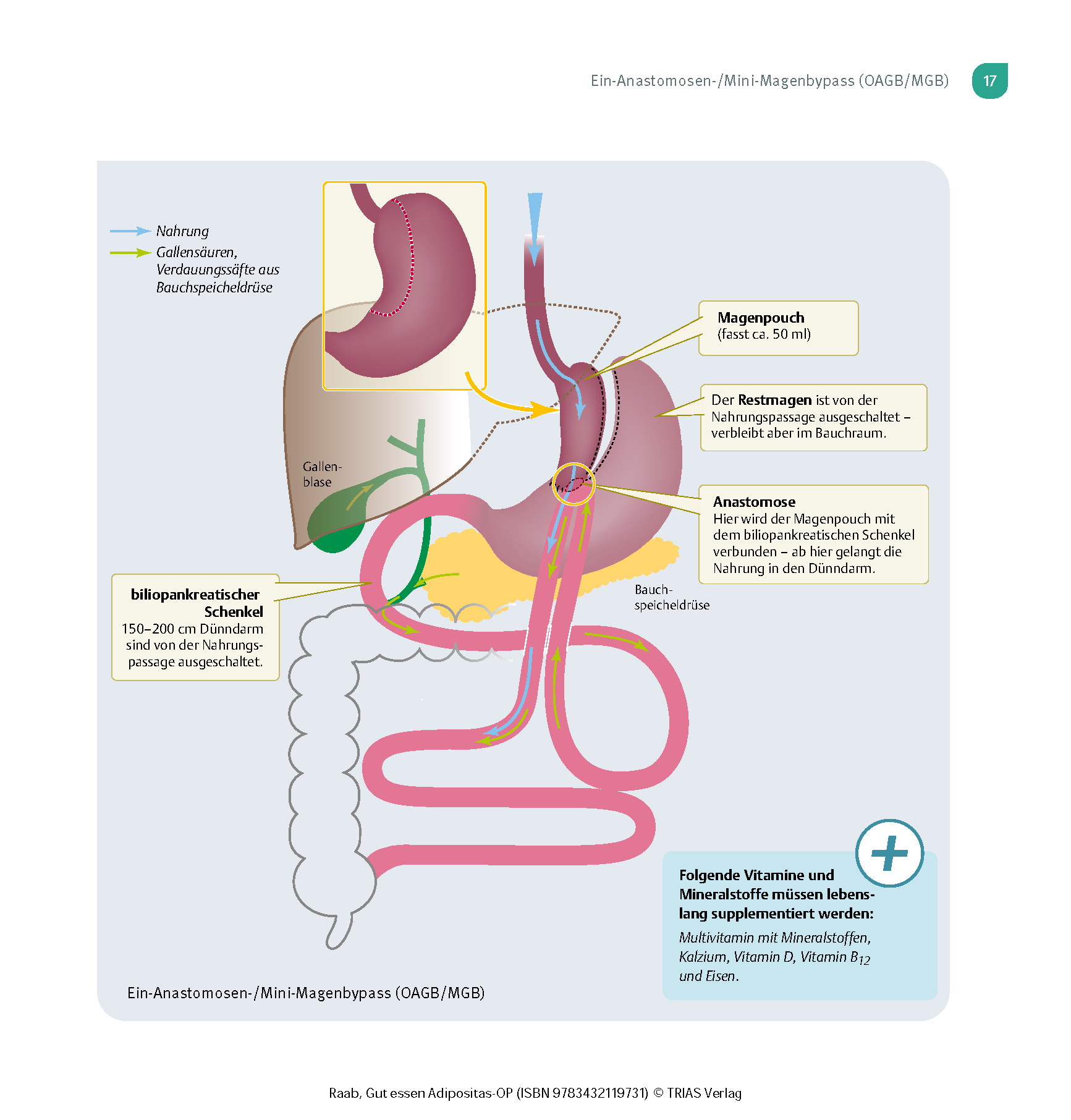 Gut essen Adipositas-OP Gut essen Adipositas-OP
