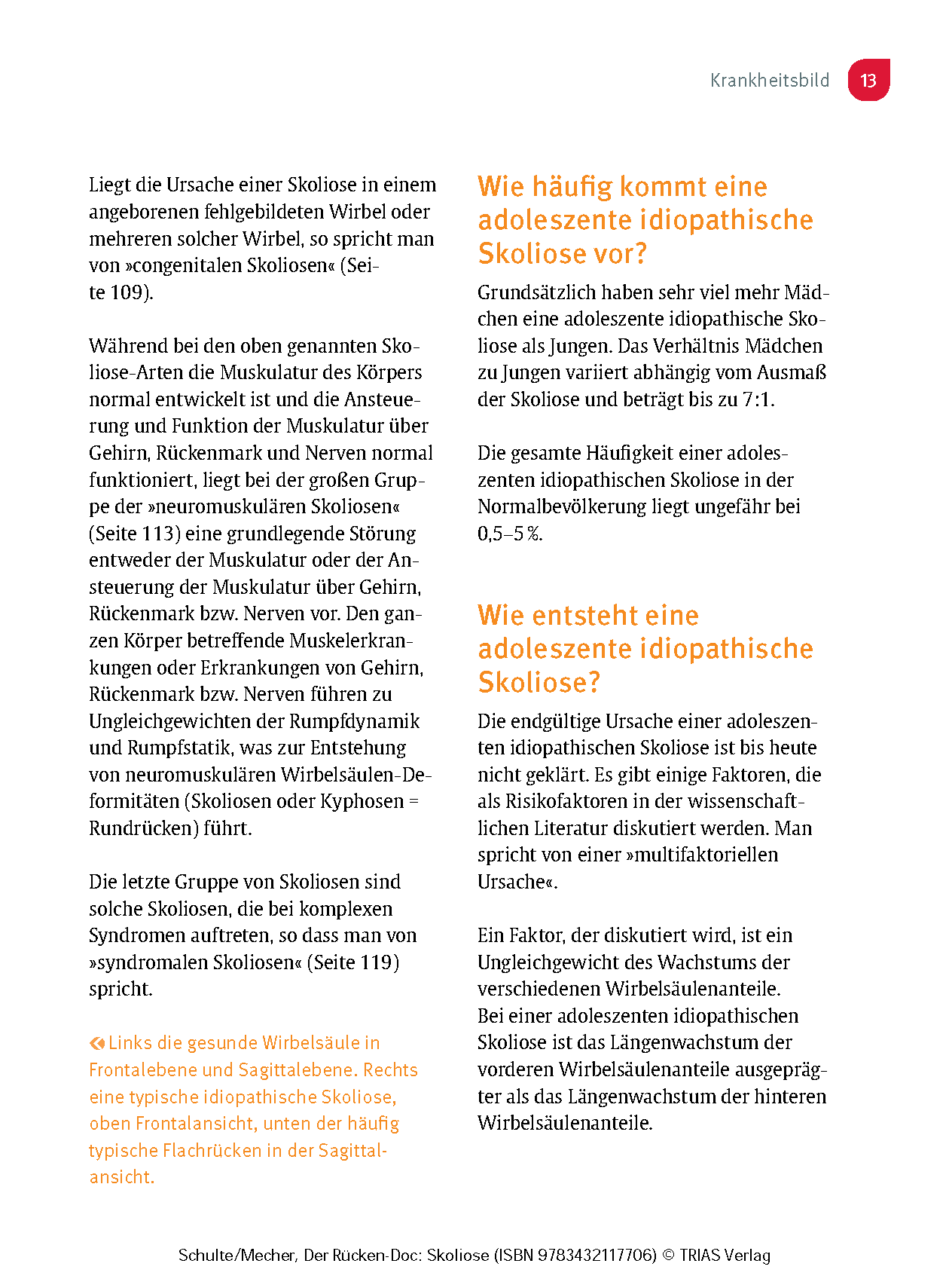 Der Rücken-Doc: Skoliose