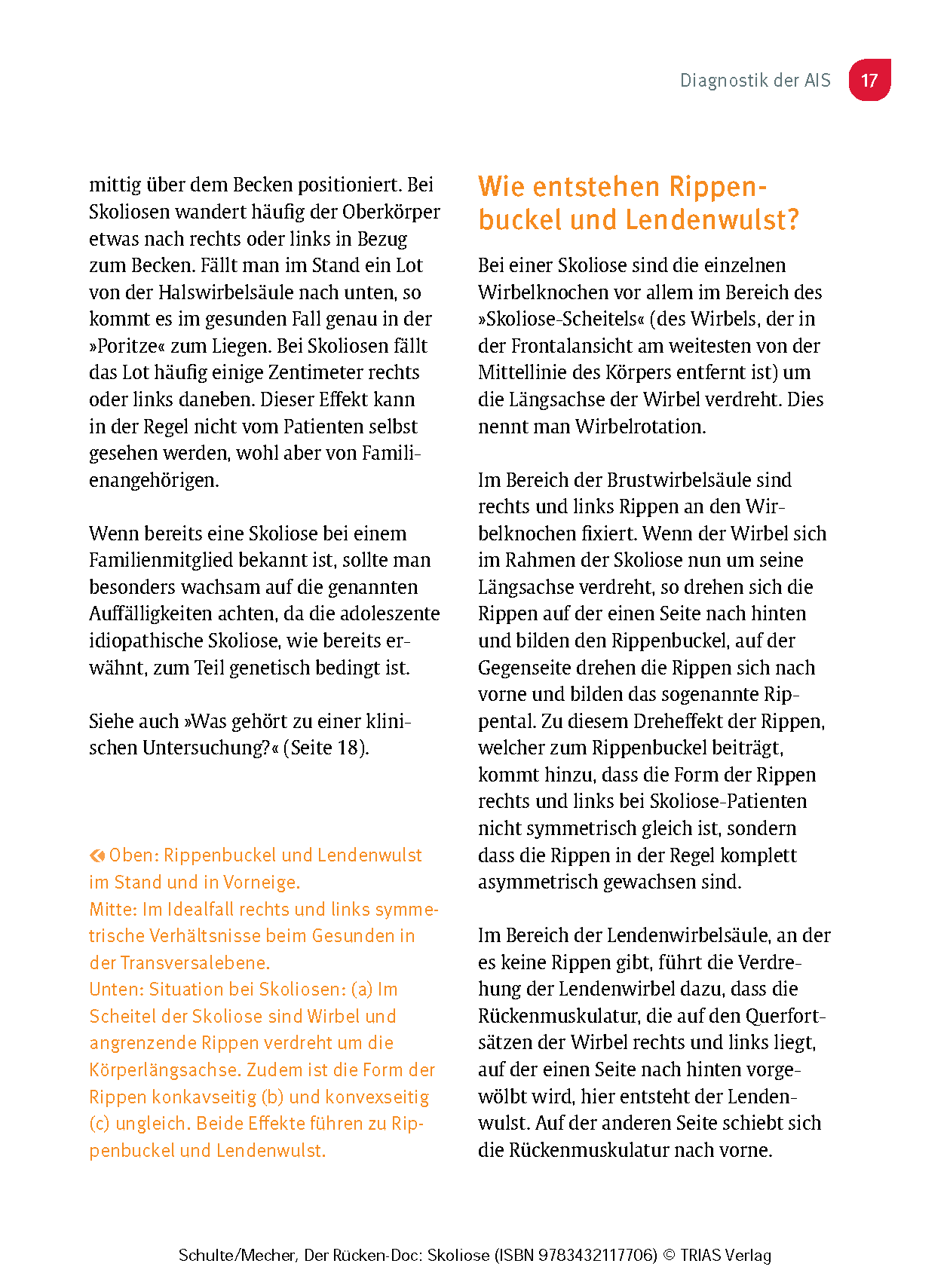 Der Rücken-Doc: Skoliose