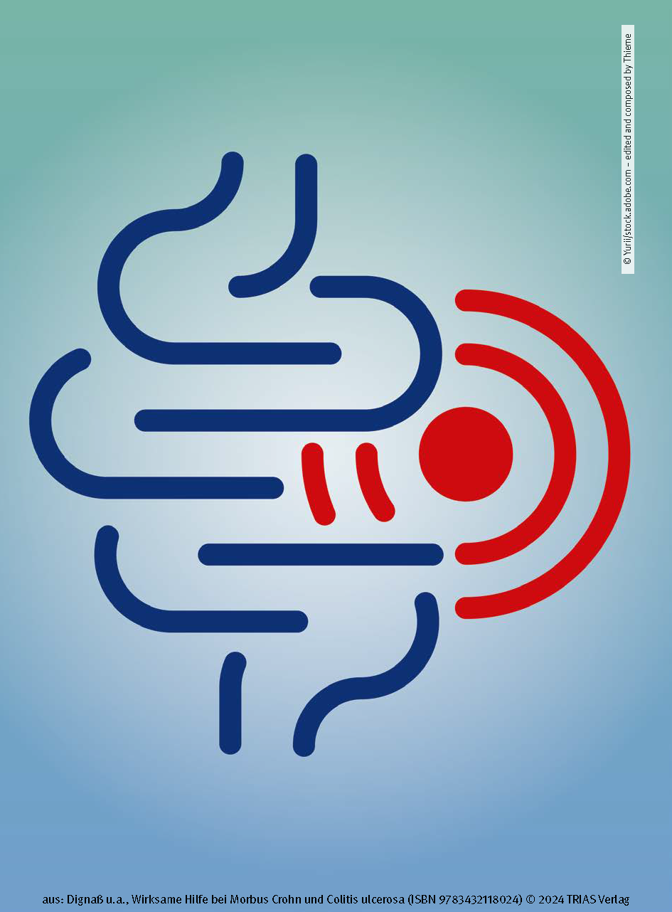 Wirksame Hilfe bei Morbus Crohn und Colitis ulcerosa