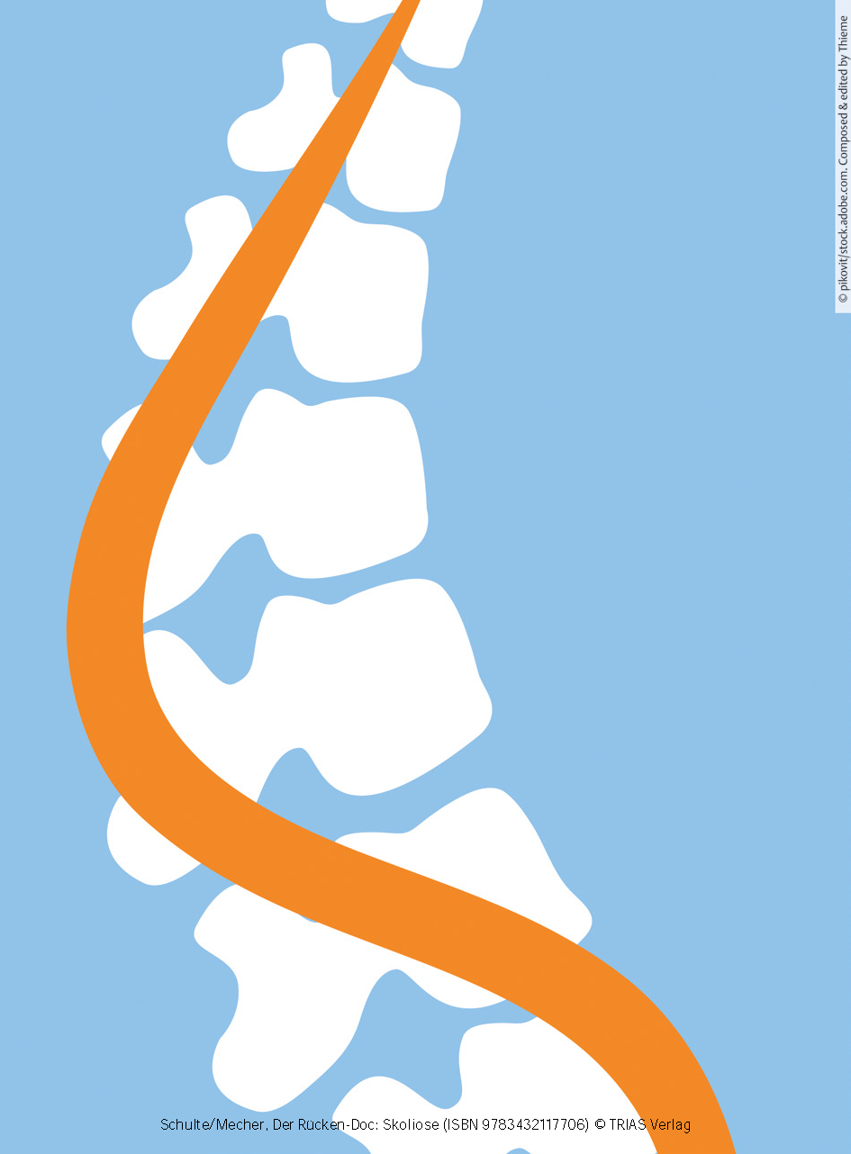 Der Rücken-Doc: Skoliose
