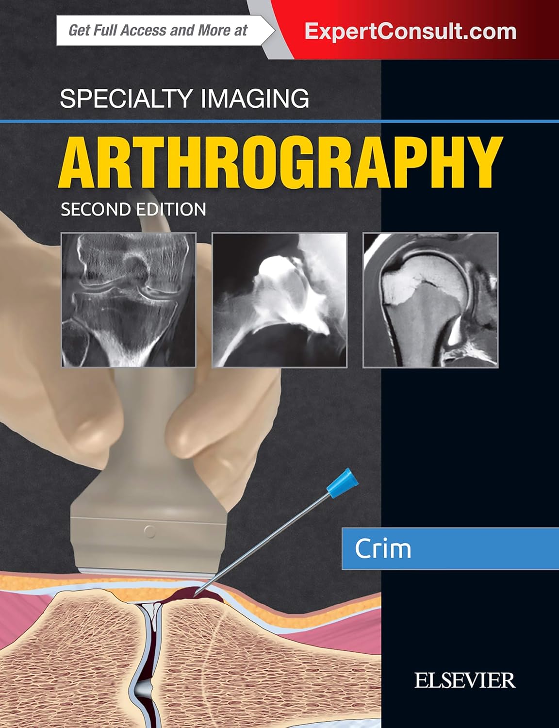 Specialty Imaging: Arthrography: ExpertConsult.com