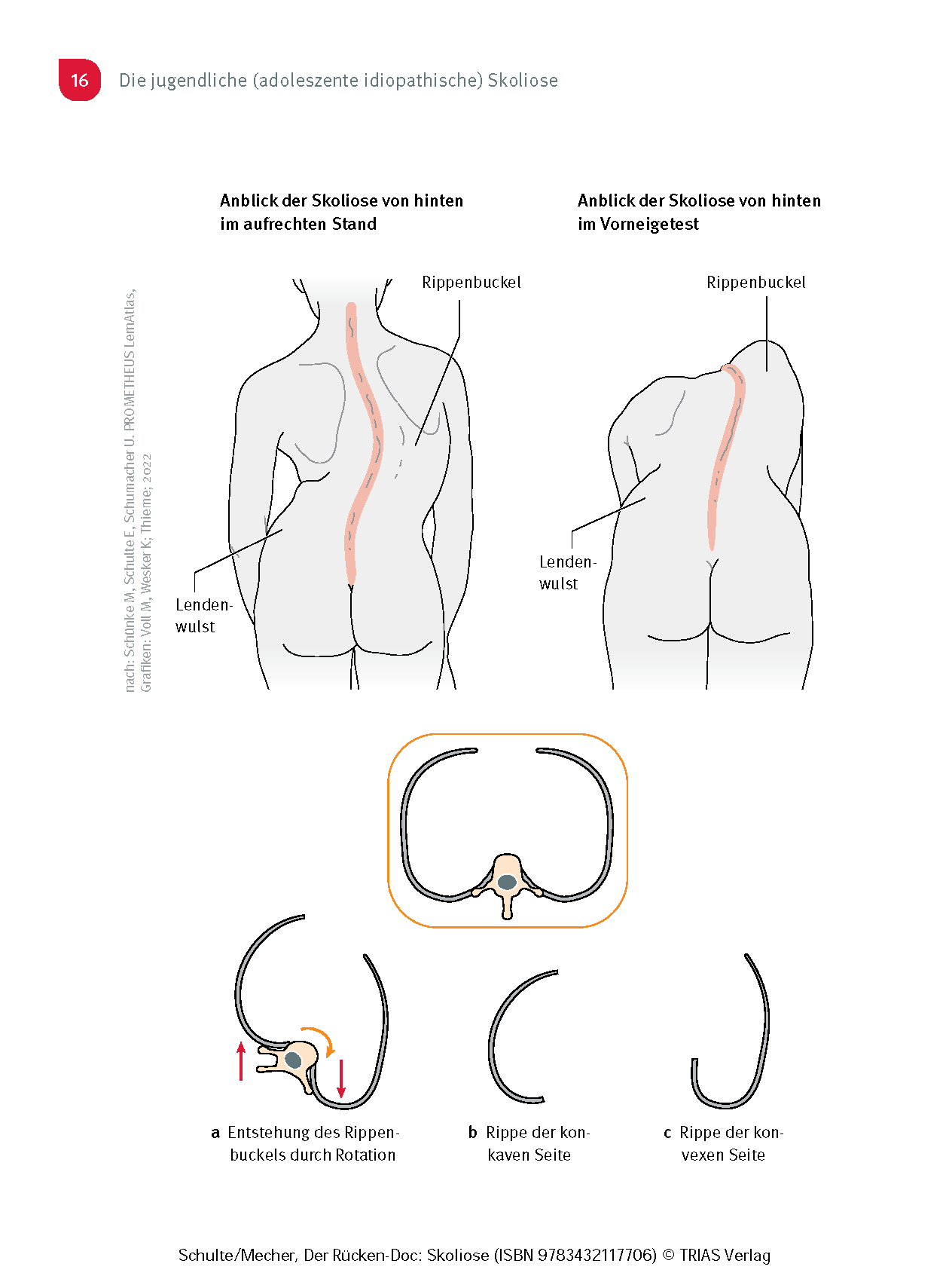 Der Rücken-Doc: Skoliose
