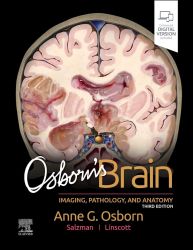 Osborn's Brain: Imaging, Pathology, and Anatomy