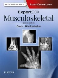 ExpertDDx: Musculoskeletal: Diagnostic Imaging. ExpertConsult.com