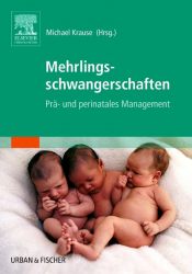 Mehrlingsschwangerschaften