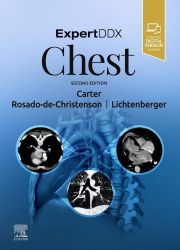 ExpertDDx: Chest